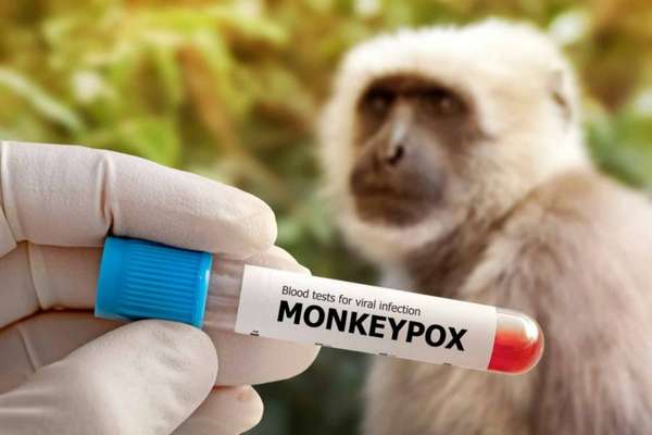 Urge prevención ante la viruela del mono en México