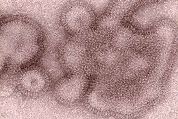 Esto sabemos de la ‘mortal’ cepa H3N2 de la influenza