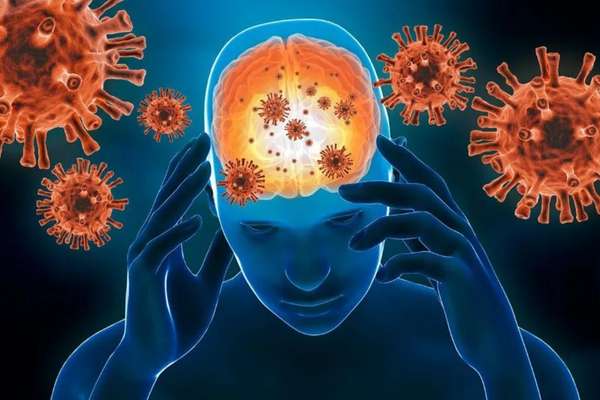 Encefalitis por covid: Una de las complicaciones del virus