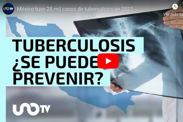 En 2022 se registraron más de 28 mil casos de tuberculosis en México; ¿es posible prevenir la enfermedad?