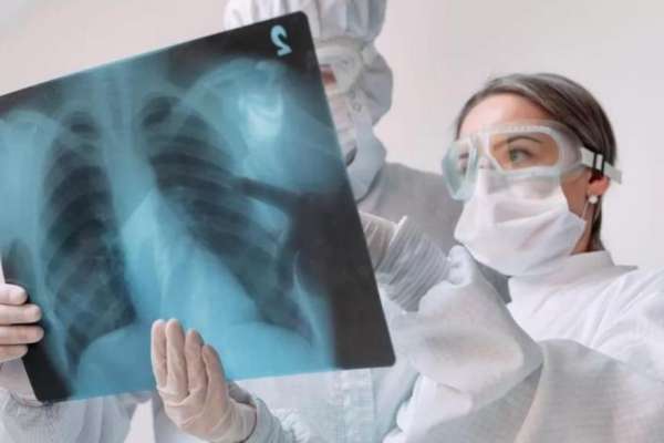 Casos de tuberculosis en México aumentan 45.3%