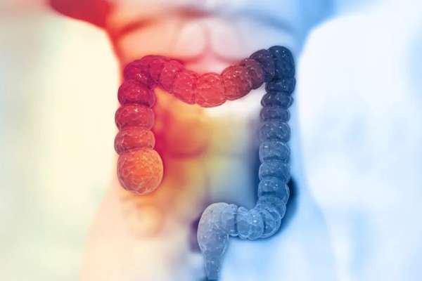 ¿Cómo prevenir el cáncer de colon Importancia de la colonoscopía