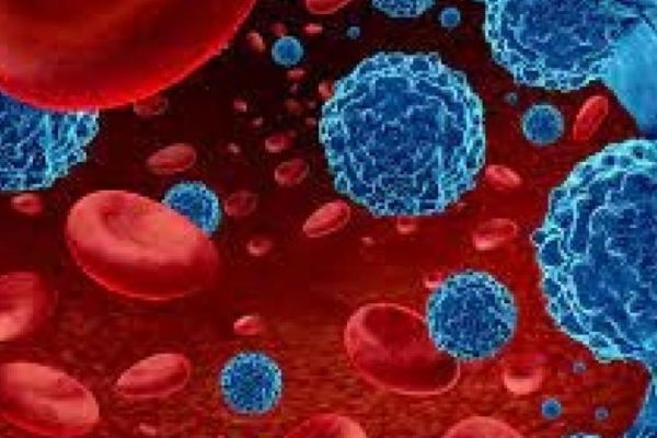 Leucemia Mieloide Aguda (LMA), uno de los tipos de cáncer en sangre más complejos y difíciles de tratar